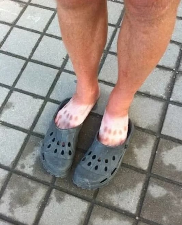 4. Носить кроксы - это тоже небезопасно!