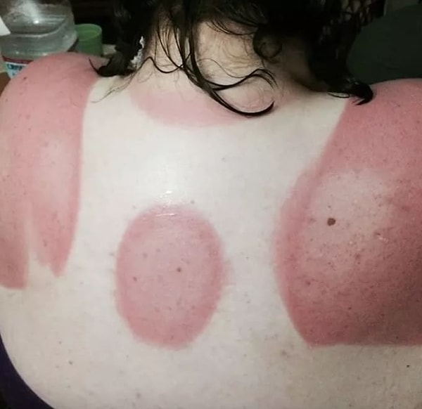 7. Солнце всегда найдёт подход