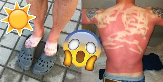 18 людей, которые СИЛЬНО перестарались с загаром 🔥