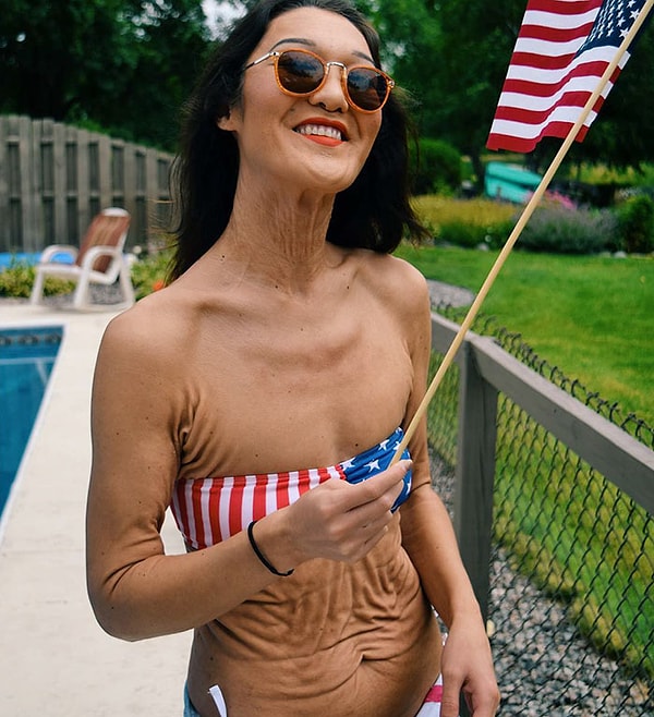 6. Сейчас Герц живет в Лос-Анджелесе и работает моделью для кампании Love Your Lines