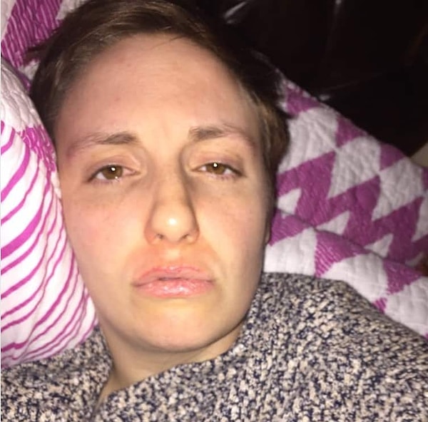 4. Все знаменитости любят показывать себя именно тогда, когда они болеют. С чего бы это? Лина Данэм решила показать себя во время синусовой инфекции...