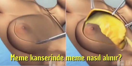 Vücudumuzla İlgili Hem Öğrenip Hem de Efsane Şaşıracağınız 17 Görüntü