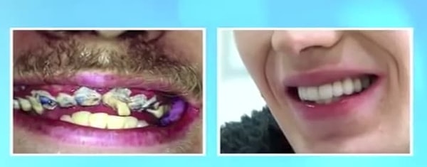 9. Оцените ДО и ПОСЛЕ: