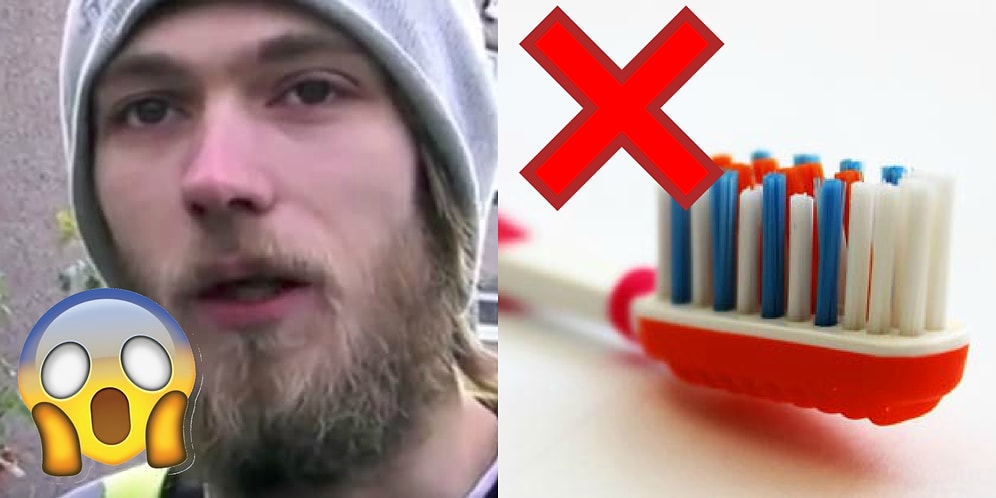 Этот парень не чистил зубы 20 (!) лет, и вот что из этого вышло 😱
