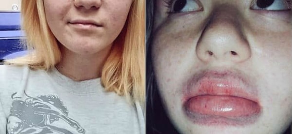 1. Губы в стиле Кардашян