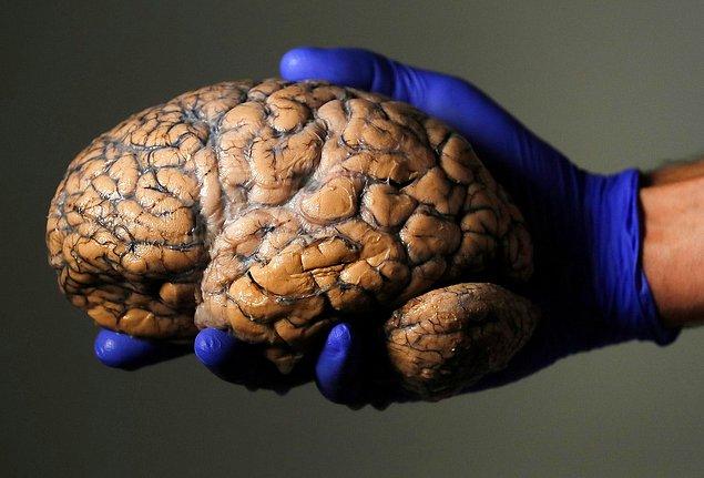 15. Belçikalı araştırmacı Jeroen Schuermans psikiyatrik hastalıklar üzerinde yapılacak araştırmalar için toplanan 3.000 beyinden birini elinde tutuyor.