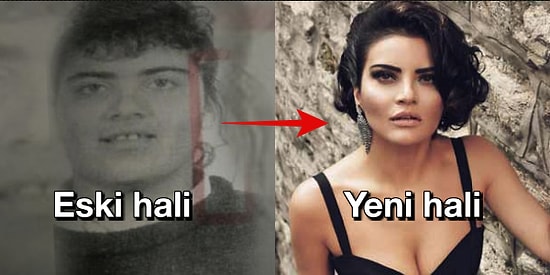 Değişim Yerine Resmen Evrim Geçirerek O Eski Hallerinden Eser Kalmayan Ünlü İsimler