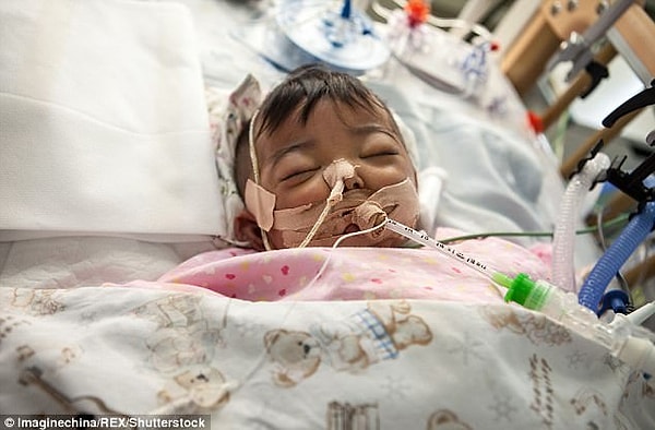 1. Родители Менган сказали врачам, что отказываются от лечения в январе, когда девочке было всего 3 месяца.