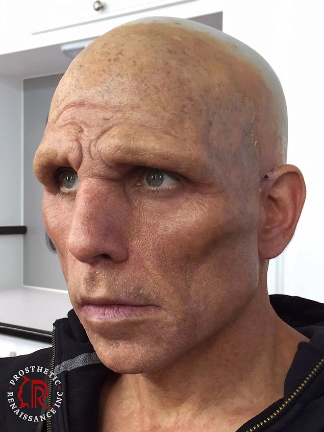 17.