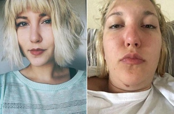 1. Одна фотография с аватарки, другая - обычное фото