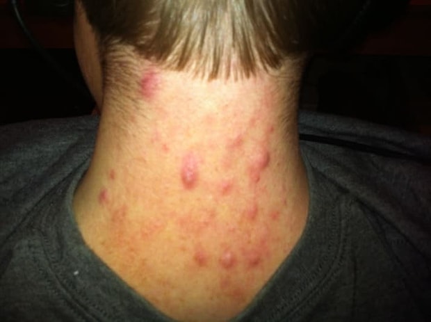 Sadece Bir Masaj Terapistinden Duyabileceginiz 22 Meslek Sirri