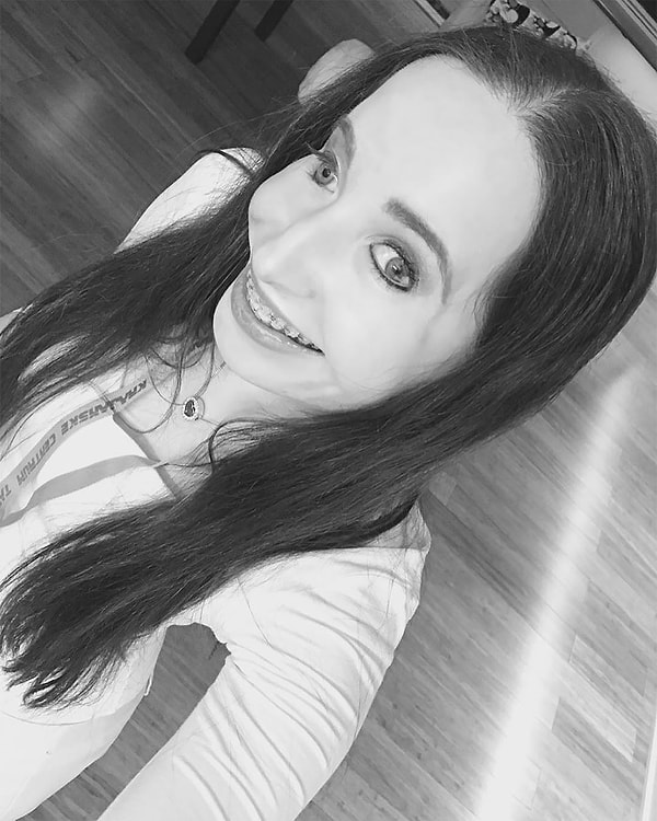 4. Другая половина оказалась изуродована болезнью, из-за чего эта мужественная женщина всю жизнь подвергается насмешкам