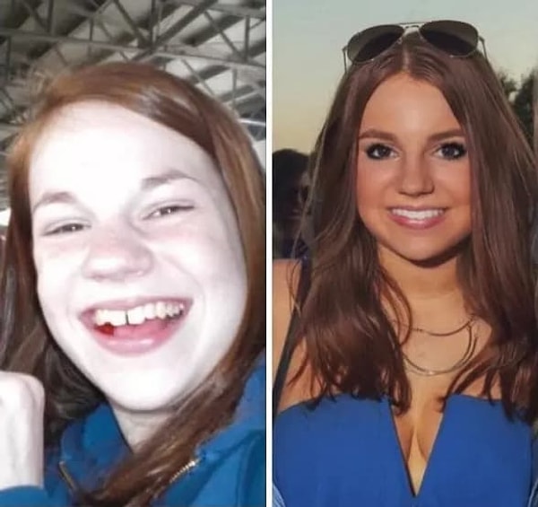 19. Разница пять лет!