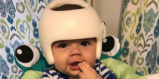 Этот очаровательный малыш в шлеме и его семья растопят ваше сердце