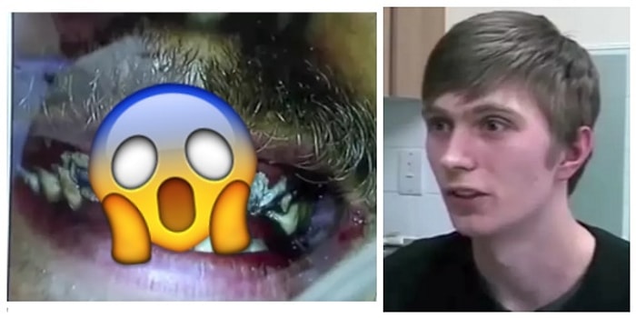 Neyse ki Diş Hekimleri Var! 20 Yıldır Dişlerine Fırça Sürmemiş Adamın İbretlik Hikayesi