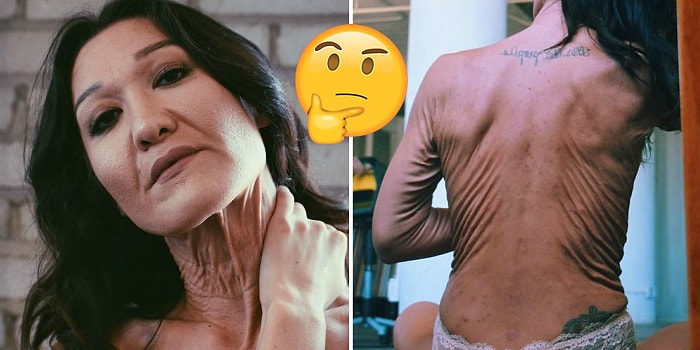 26 Yaşında Sahip Olduğu Kırışıklıklarla Güzellik Standartlarına Meydan Okuyan Model