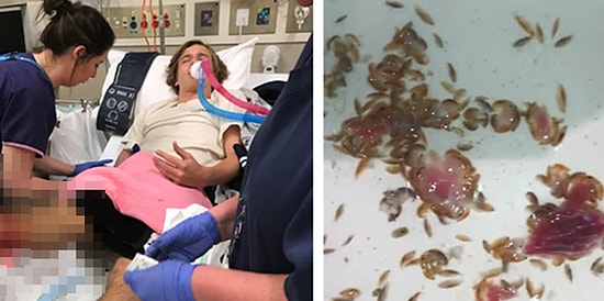 Avustralya'da Denize Giren Gencin Ayaklarını Nadir Görülen Bir Parazit Kemirmiş Olabilir!