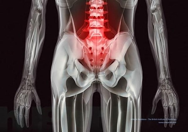 8. Боль в спине выглядит именно так