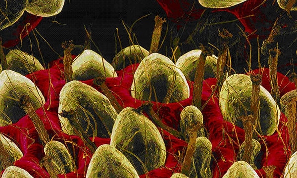 7. Вот так клубника выглядит под микроскопом