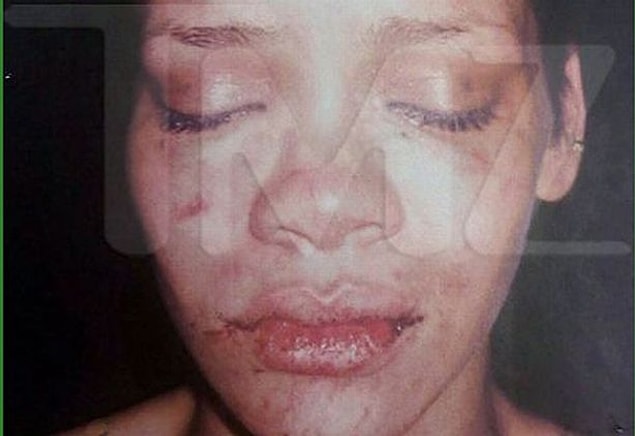 Ayrılık dedikoduları, aldatma iddiaları derken çift olabilecek en korkunç haberlerden biriyle gündeme geldi: Chris, Rihanna'ya şiddet uygulamıştı.