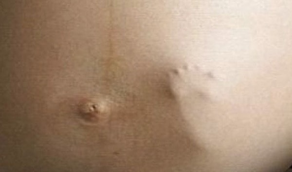 5. «Ножка ребенка толкает маму в живот»