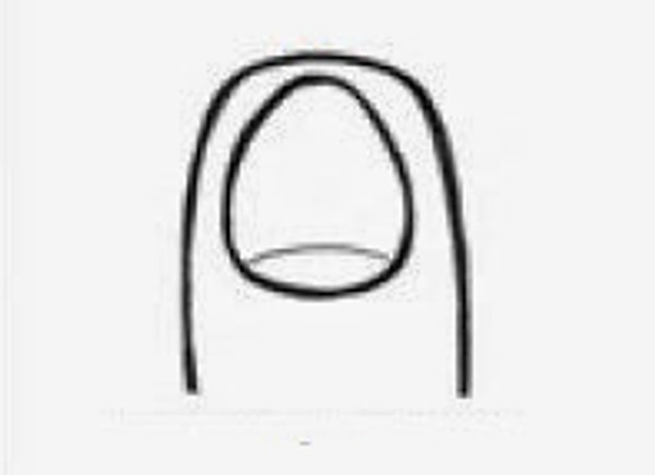 Неровные и короткие