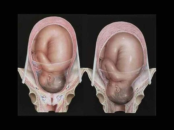 Bağ doku sayesinde kafatası kemikleri hareket edebilir ve bebek dar olan doğum kanalından rahatça çıkabilir.