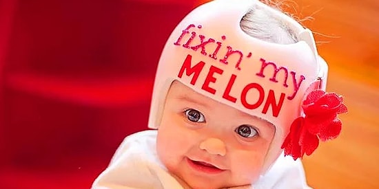 Bunu Herkes Mutlaka Düşünmüştür: Yeni Doğan Bebeklerin Kafası Neden Yumuşak Olur?