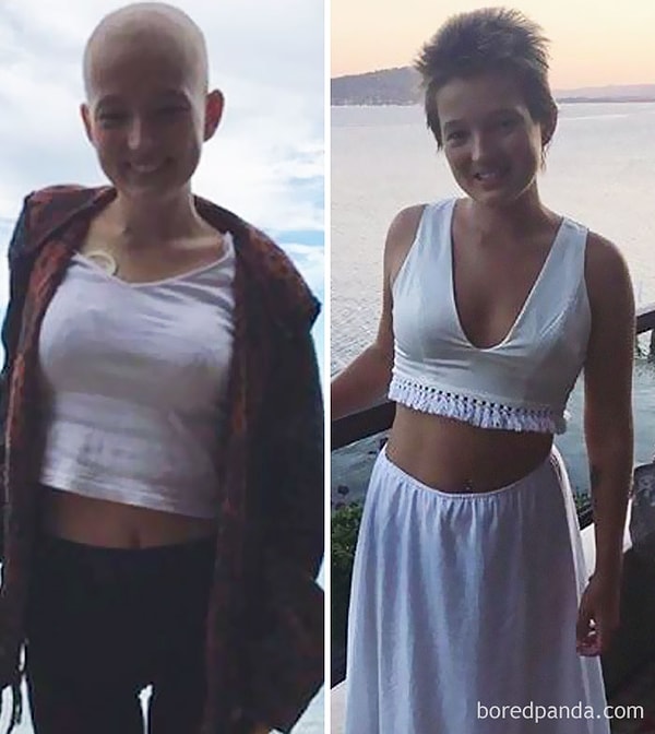 4. "Я выжила на 4-й стадии рака. И уже целый год без рака! Мне давали три месяца, но сегодня я полностью излечилась".