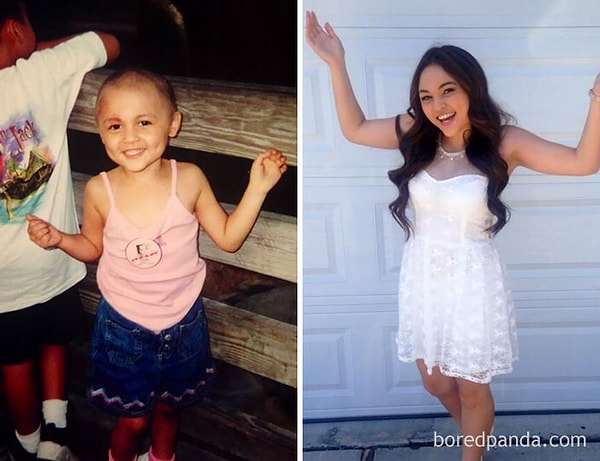 19. "Вылечилась и смогла пойти на выпускной!"