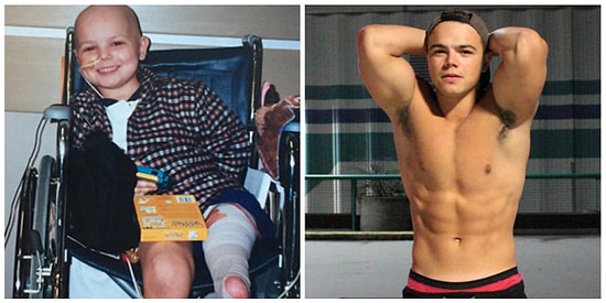 Увидев фото этих 20 людей, победивших рак, вы посмотрите на свою жизнь по-новому