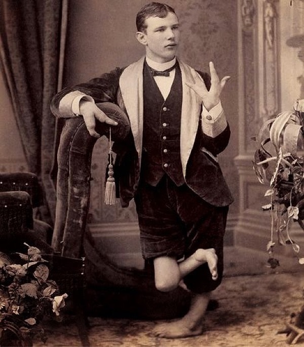 5. Фред Уилсон - "Человек-креветка"