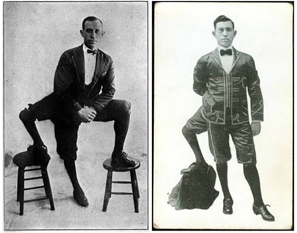 10. Франческо Лентини - цирковой артист с тремя ногами.