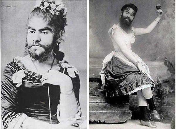 13. Энни Джонс, гастролировавшая с цирком как "американская бородатая женщина".