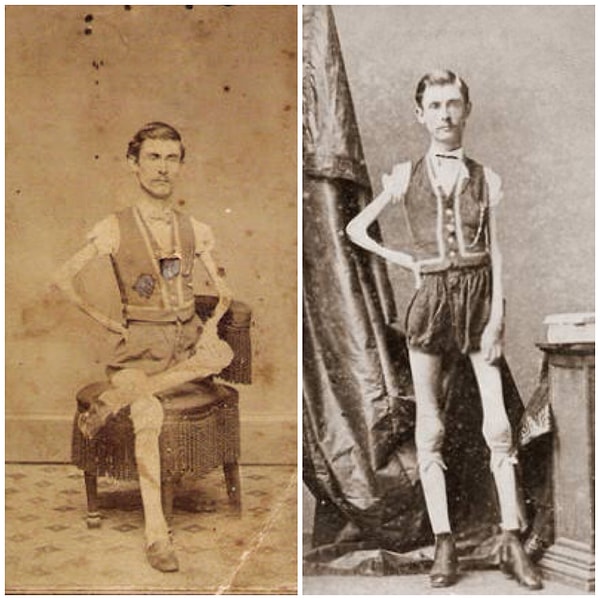 16. Исаак Спрэг - "Живой скелет"☠️