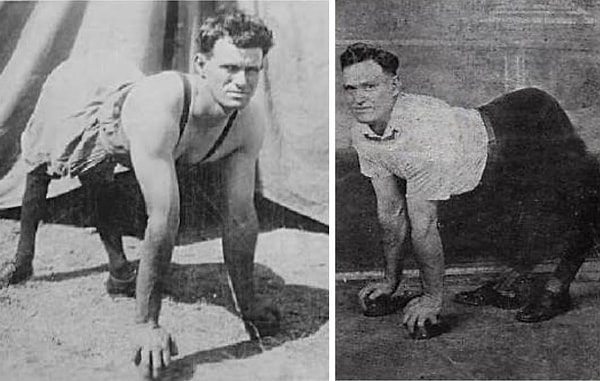 17. Роберт Хаддлстон, которого прозвали "Мальчик-пони".