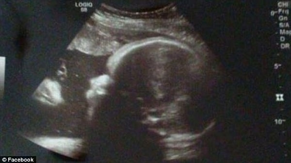 1. Слева на снимке можно увидеть силуэт бородатого мужчины, который смотрит на еще не рожденного ребенка.