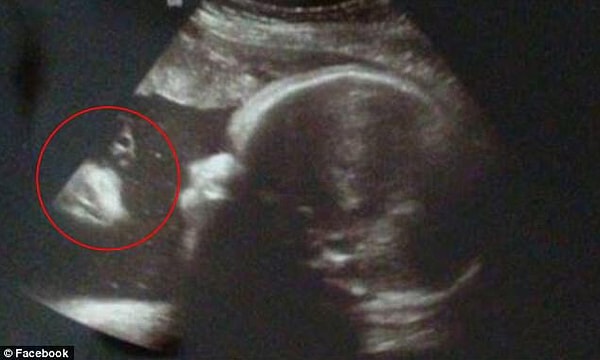 2. Алиша говорит: «Когда они дали нам снимок… эм… для меня это Иисус».