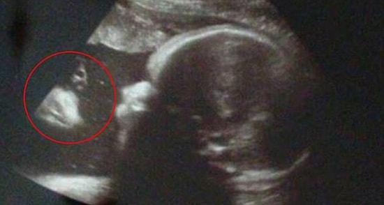 Пара увидела Иисуса на снимке с УЗИ