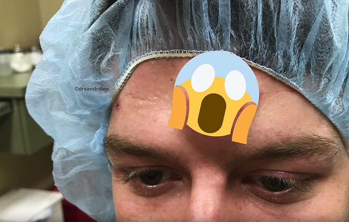 Alnındaki Unicorn Kistinden 6 Yıl Sonra Kurtulan Adam