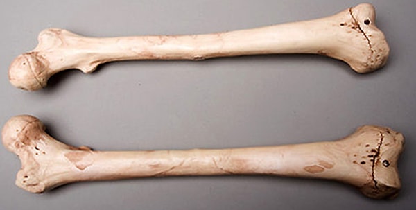 3. Не забывайте о вреде для своих же костей