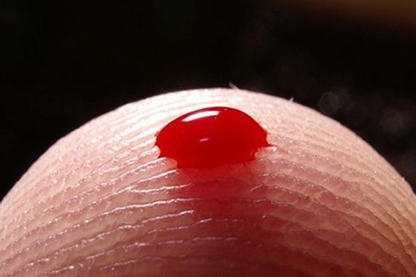 6. Узнайте о первых симптомах сахарного диабета