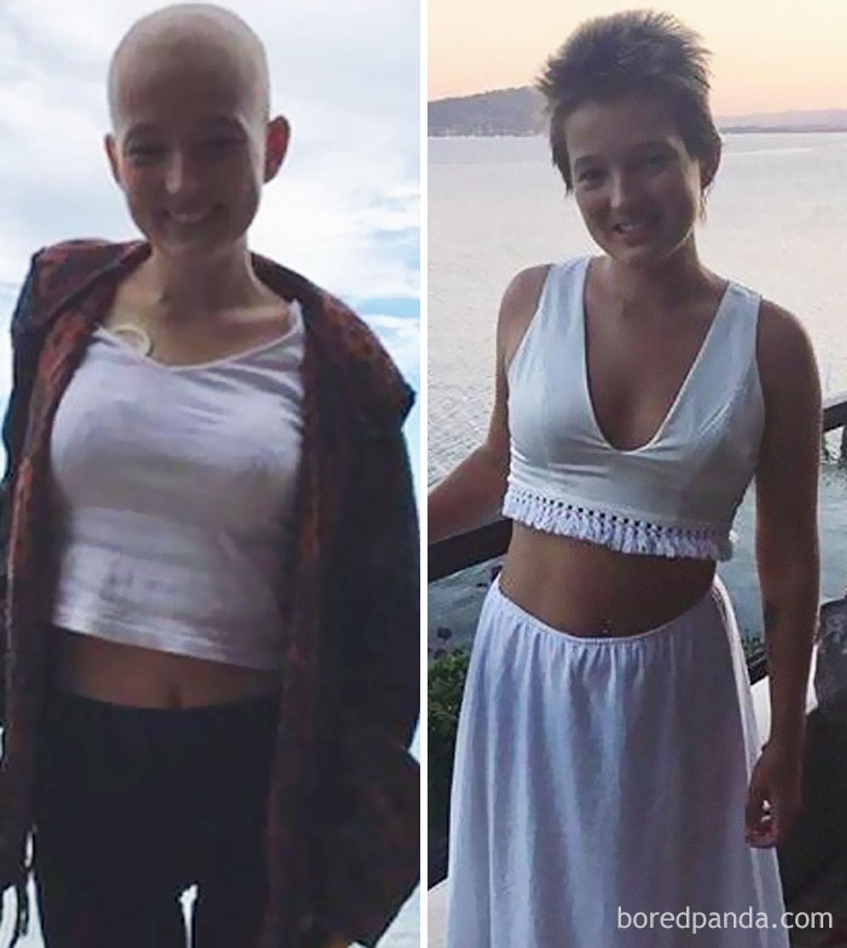 Победили рак сами. Люди после химиотерапии. Люди после химиотерапии до и после.
