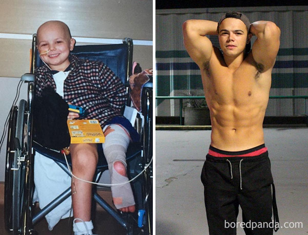 Победили рак сами. Люди с онкологией до и после. Люди победившие болезнь. Мужчины до и после химиотерапии. Раковые больные до и после.