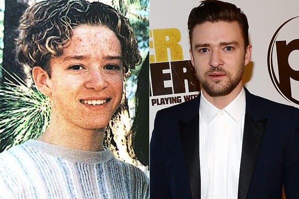 10. Джастин Тиберлейк: ничто человеческое ему не чуждо. Да, мы про акне