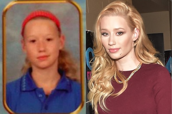 15. Игги Азалия: "до" и "после"