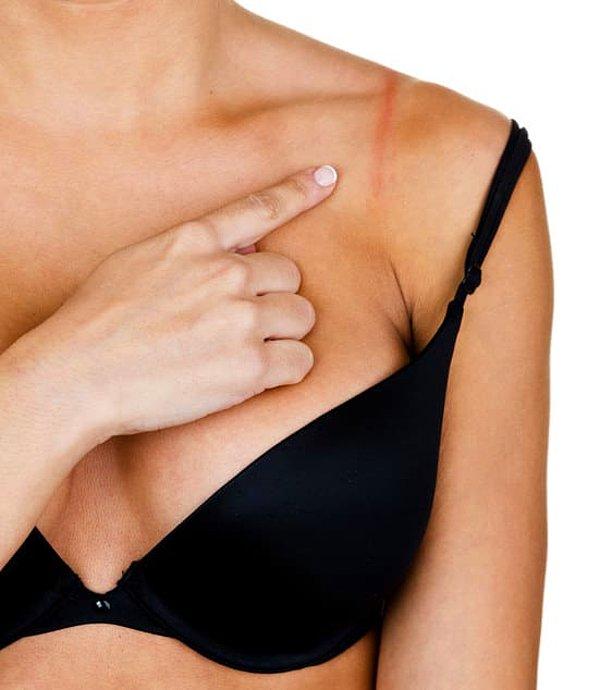 Breast Augmentation for Uneven Breasts