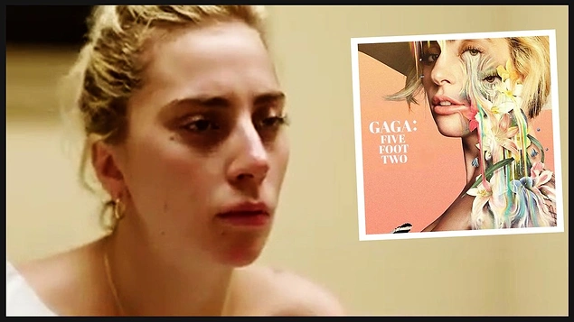 Lady Gaganın gizemli hastalığı: Fibromiyalji 93