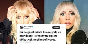 Büyük Geçmiş Olsun! Fibromiyalji Mağduru Lady Gaga Farkındalık Yaratmak İstiyor