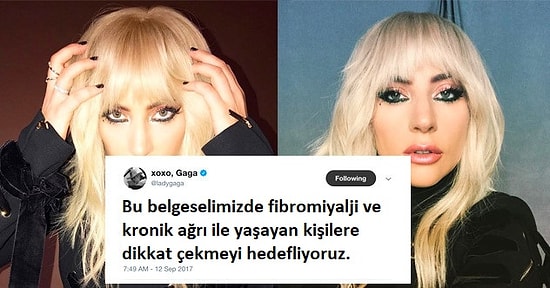 Büyük Geçmiş Olsun! Fibromiyalji Mağduru Lady Gaga Farkındalık Yaratmak İstiyor